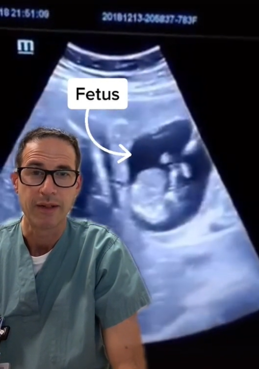 寶寶異位妊娠在肝臟。(圖/TikTok nicu_musings)