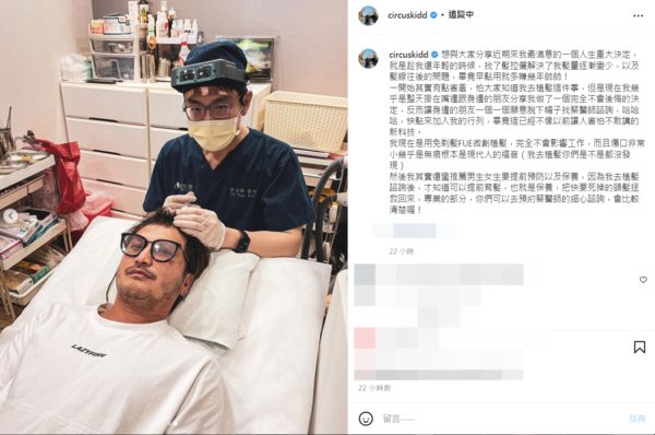 KID林柏昇於近日做植髮手術。(圖/翻攝自Instagram/circuskidd)