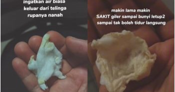 馬來西亞一名女子法麗達（Faridah Arshad），日前用棉花棒清理完耳朵後突然感到劇烈疼痛，且耳朵還不斷流出黃色膿液，結果居然是耳膜被她給挖破了。（圖／翻攝自《sfadaah》TikTok）
