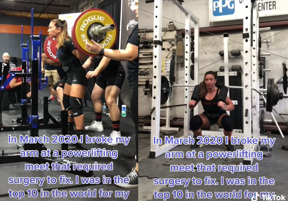 舉槓鈴舉到骨頭斷掉插出來。(圖/TikTok powerlifting_portagee)
