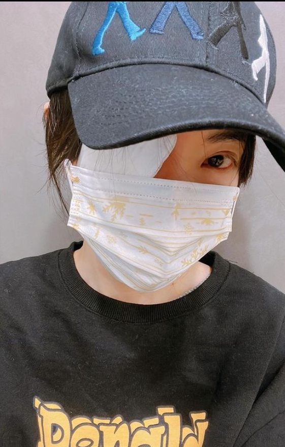 謝金燕有針眼的宿疾。（圖／翻攝自IG）