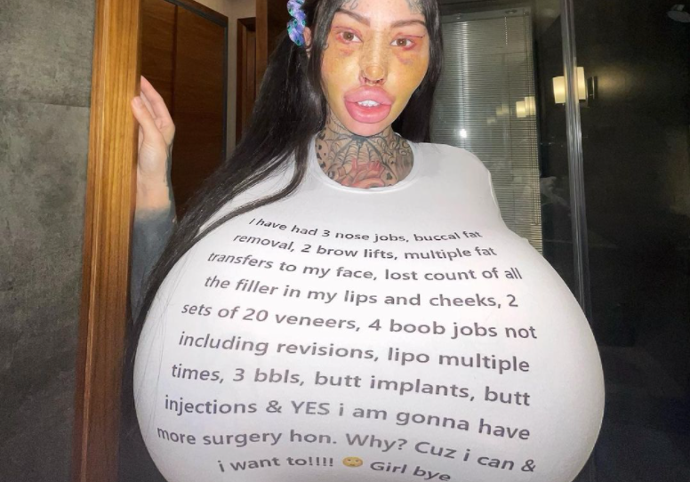 加拿大一名26歲女模瑪達肋納(Mary Magdalene),近年來因不斷整形分享網紅照,吸引不少粉絲關注。(圖/翻攝自IG/@1800leavemaryalone)