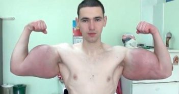 俄羅斯男子基里爾（Kirill Tereshin）將油注入手臂。（圖／推特）