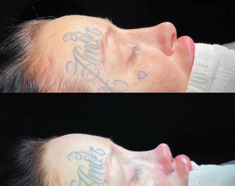 為了讓自己更加美豔,瑪達肋納透露這次動了「芭比鼻」及「貓眼」,並大方公開自己術後的臉部腫痛模樣。(圖/翻攝自IG/@1800leavemaryalone)