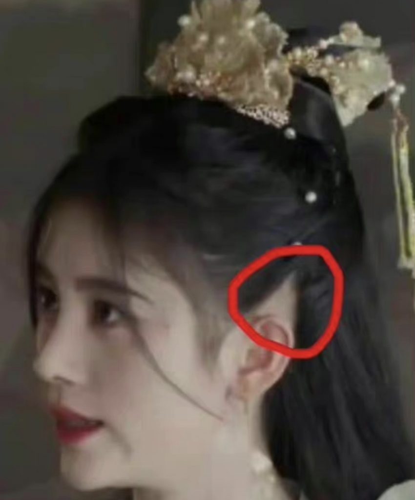 鞠婧禕因耳後露出一大塊皮膚,遭指禿頭。(圖/翻攝自微博)