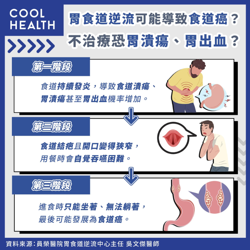 胃食道逆流可能導致食道癌？不治療恐胃潰瘍、胃出血？（圖／潮健康）