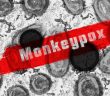 俄羅斯大內宣控烏克蘭是猴痘起源地。（示意圖／Pixabay）