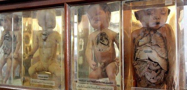  「西里拉醫學博物館」展覽了許多真的屍體。（圖／取自thairath.co.th）