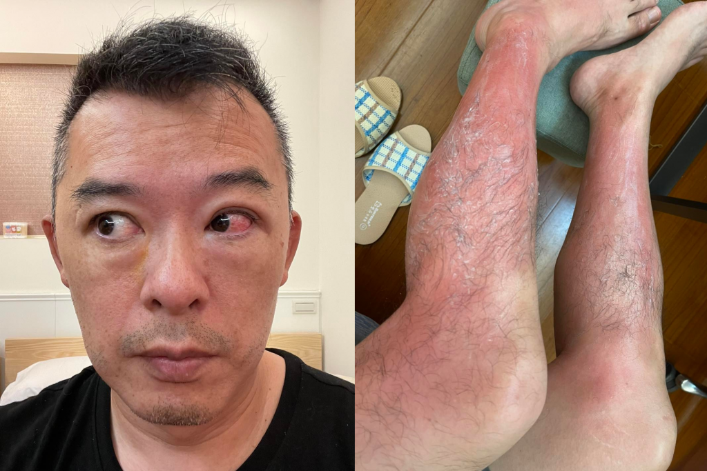 Andy老爹呼籲民眾使用紫外線殺菌燈時千萬要小心。(圖/翻攝自臉書「Andy老爹」)