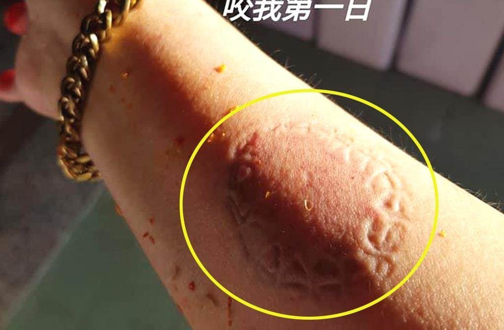 李姓前空姐縱火燒死丈夫遭判15年徒刑(攝自爆料公社)