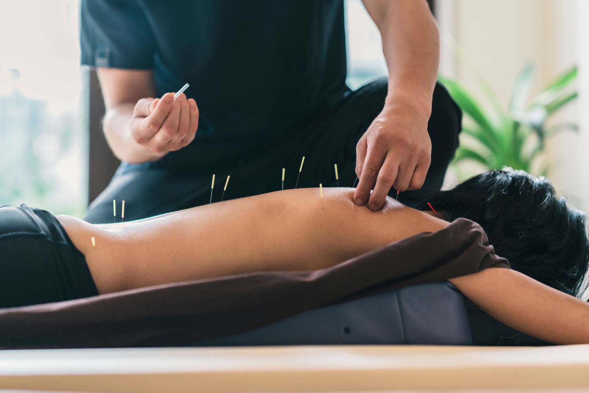 Therapist Giving Cupping Treatment To Young Asian Woman Insurance for Acupuncturists