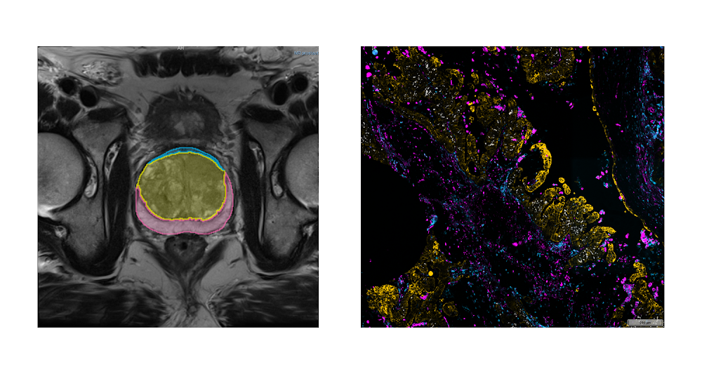 Sample images from NCI Imaging Data Commons.