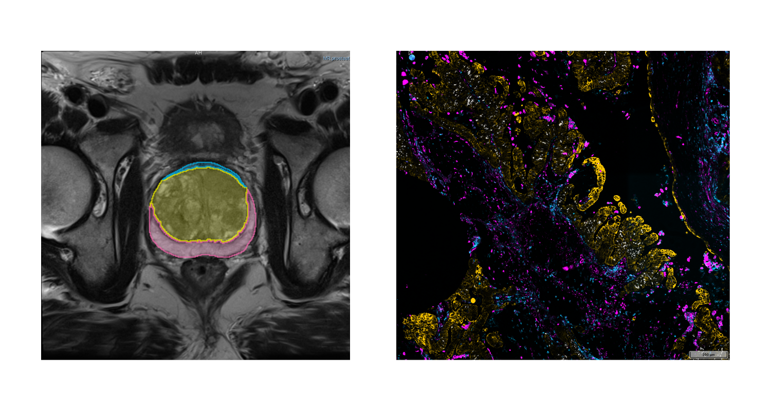 Advancing cancer research with public imaging datasets from the