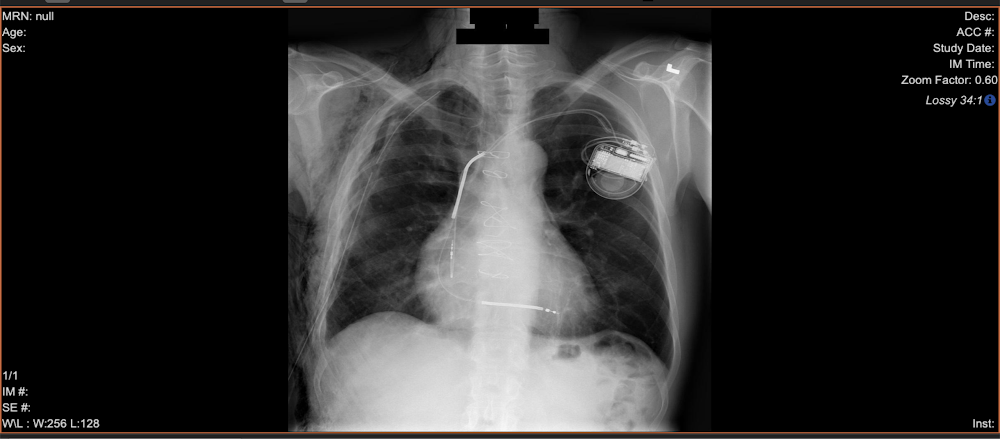 x-ray de-identification.png