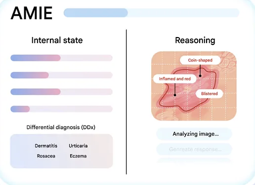 AMIE is an AI system with diagnostic reasoning. It functions as a conversational partner to conduct complex medical interviews and clinical history-taking.