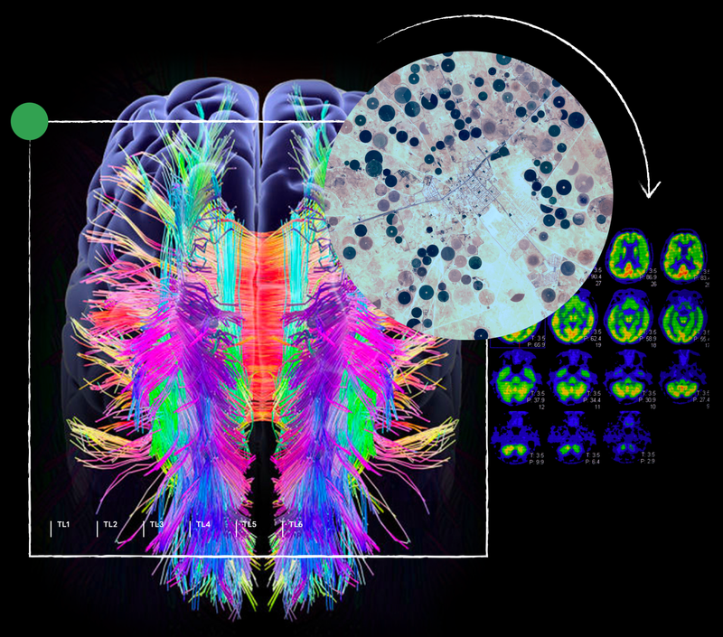 brain image