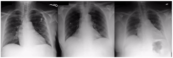 StylEx-5-Confounders