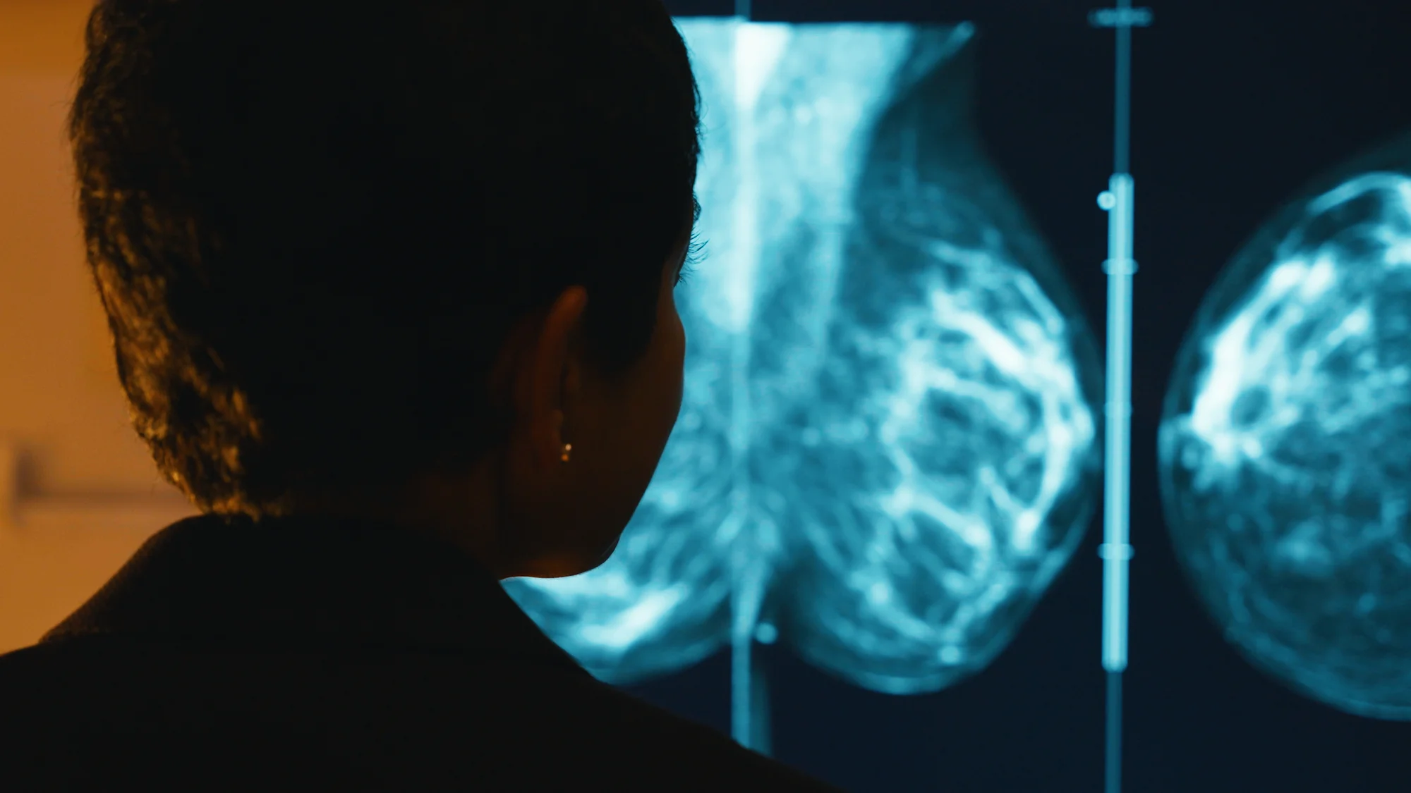 image of mammogram