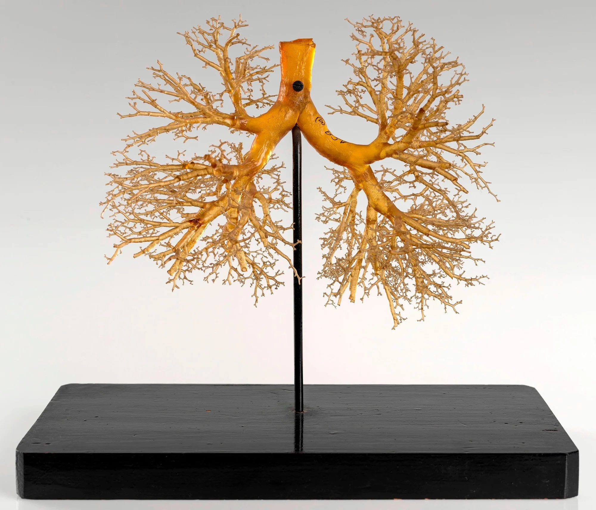 Resin cast of a human lung.