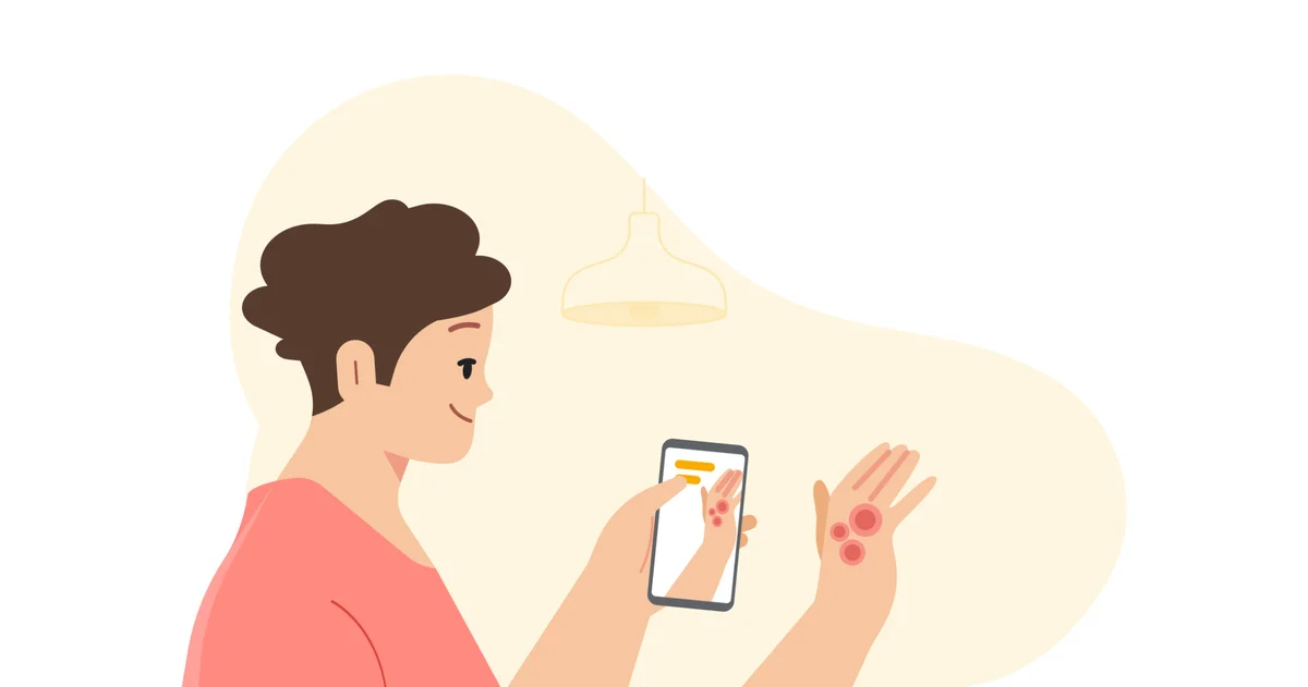 Illustration of a person in a pink shirt holding up their phone to take a picture of a skin condition on their hand.