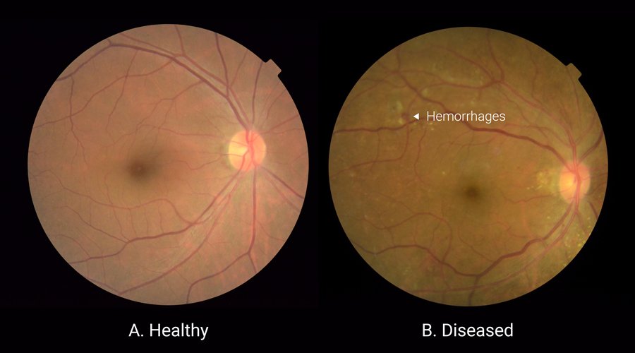 diabeticeye_900x500.jpg