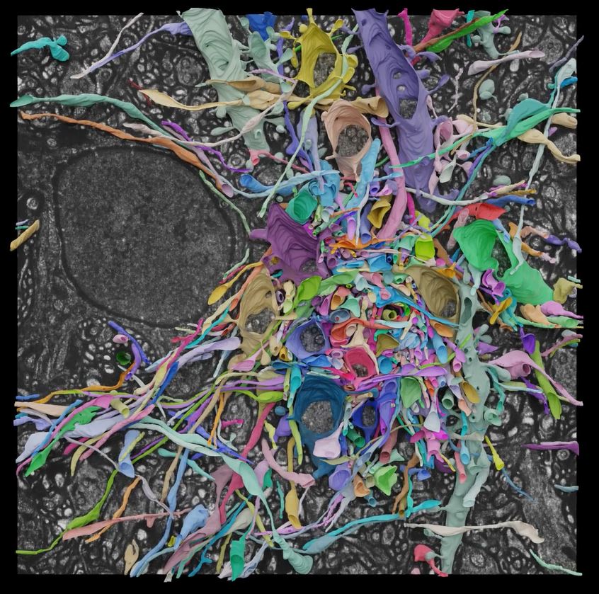 A close-up of colorful neurons woven together against a gray background
