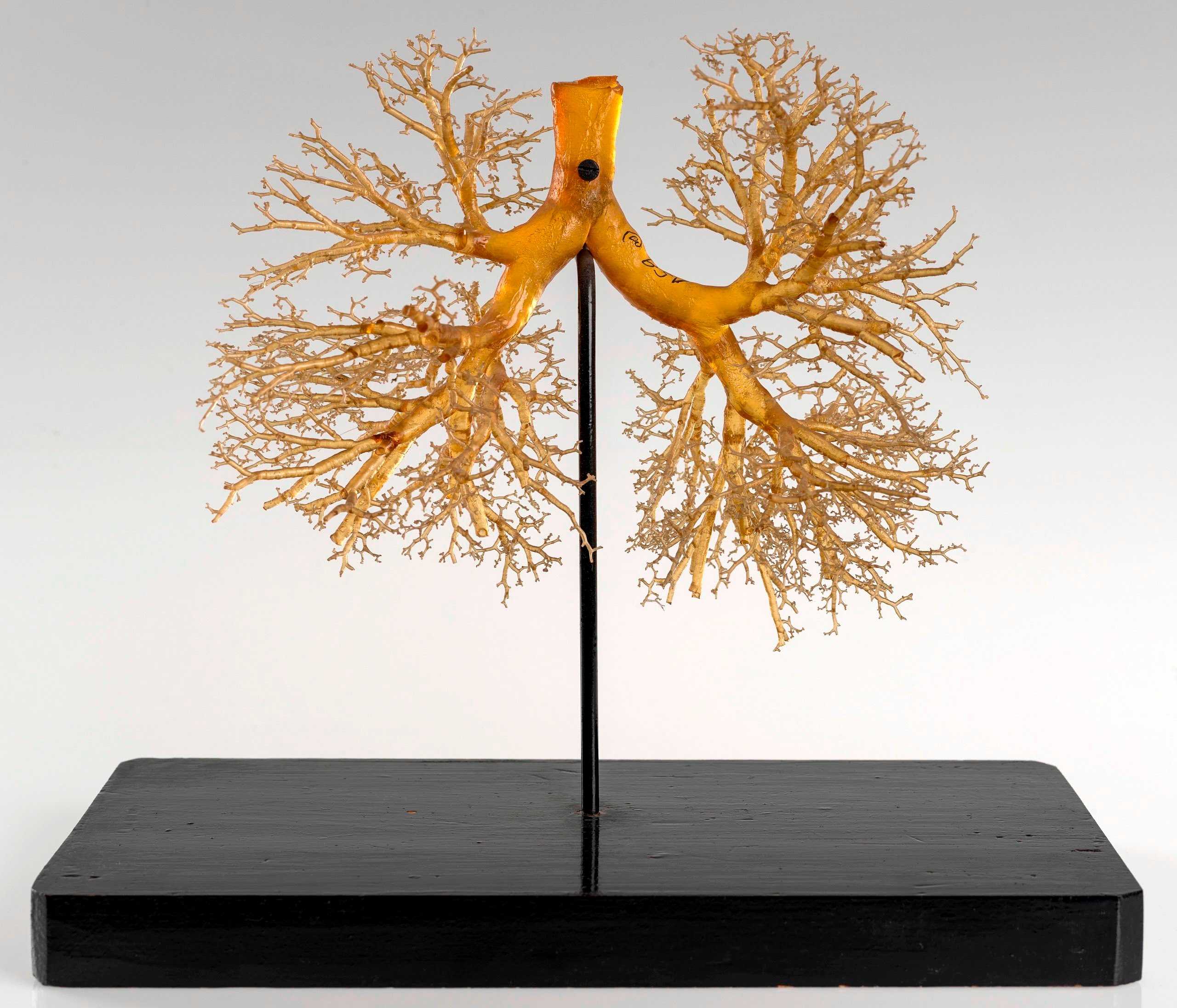 Resin cast of a human lung.