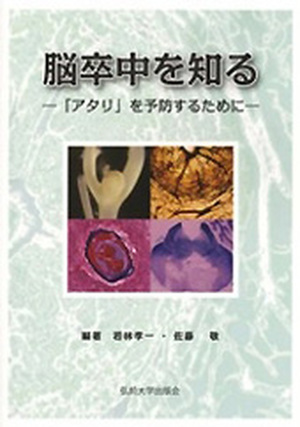 脳卒中を知る−「アタリ」を予防するために−