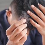 7割以上がハゲを気にしている！「薄毛の予防や対策を行っていますか？」のアンケート調査。