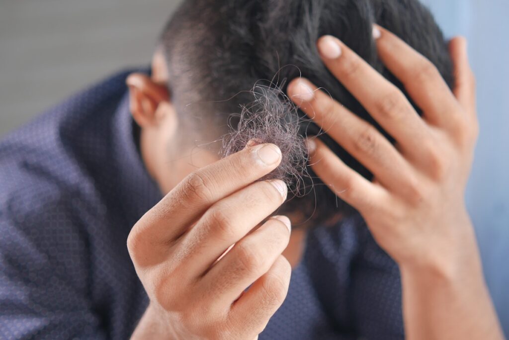 半数以上の男性が抵抗感を感じている「育毛剤・発毛剤・養毛剤購入への抵抗感はありますか？」のアンケート調査