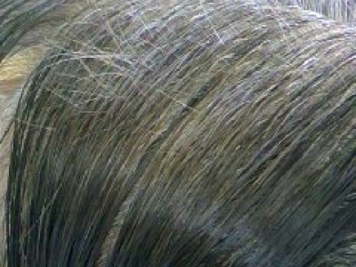 美容室angel - 育毛事例　新生毛が生えてきています。