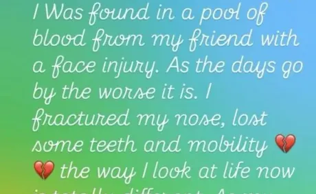 Tamar Braxton (‘Found in Pool of Blood’) Says She ‘Almost Died’ After Mysterious Accident | Video