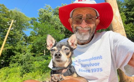 Kidney Transplant Recipient Approaches 50th Transplant Anniversary from Deceased Donor