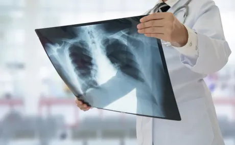 AI’s Expanding Role in Medicine: How Artificial Intelligence Is Helping Doctors Detect Cancer Earlier