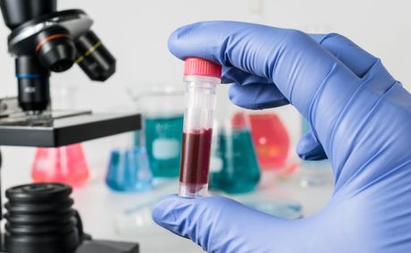 10 critical warning signs of blood cancer to watch