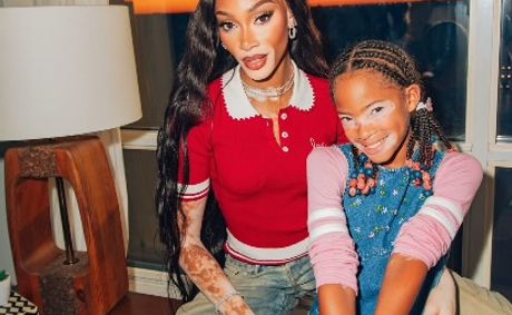 Empowering Through Visibility: Winnie Harlow Partners With Incyte To Support People With Vitiligo