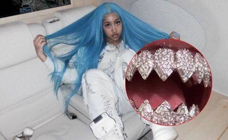 WATCH: North West Shocks Fans With Custom Ice-Cold Diamond Shark Teeth For Christmas