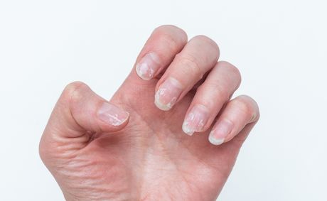 The home remedy that actually strengthens nails
