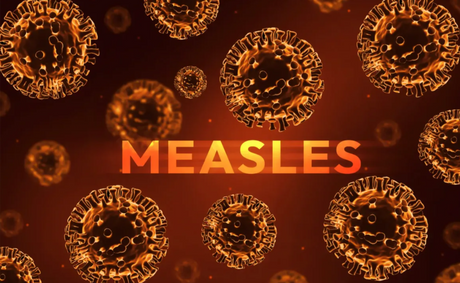 Measles as a “Cost of Doing Business” in Trump’s America.