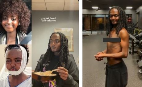 Viral TikToker Says She’s Now Fully A Man After Years Of Transition, Removing Her Uterus