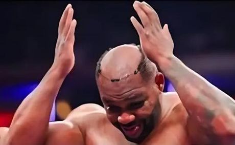 After Getting it Knocked Off in Ring, Jarrell Miller’s Viral Toupee Moment Sparks Business Opportunity Offers | VIDEO
