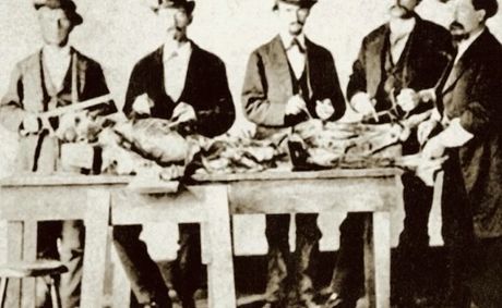 The Forgotten History of How Enslaved African Graves Were Looted for Medical Research