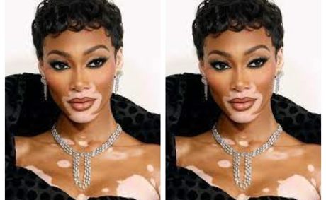 Winnie Harlow on the times she got rejected before raising over $6M for her skincare brand&nbsp;