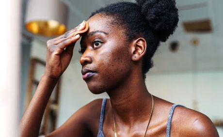 Strong Again: How Black Women Can Repair And Protect A Damaged Skin Barrier