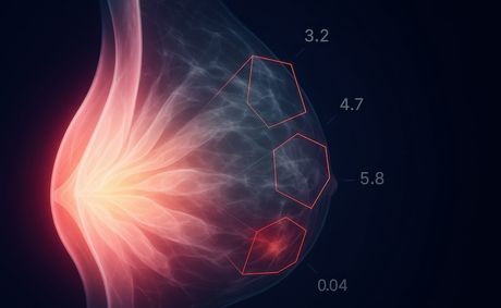 The AI-Assisted Early Breast Cancer Screening Test We Need to Know About