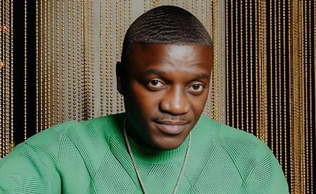 Akon Plans Hair Unit Business After Hair Transplant