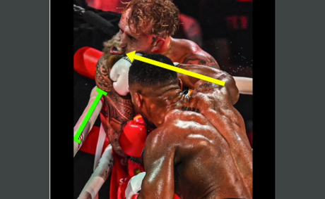 Jake Paul may never fight again after brutal injury