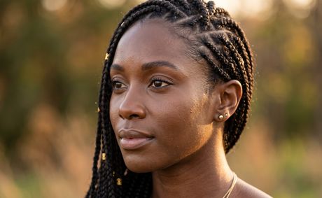 Understanding Traction Alopecia
