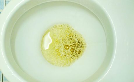 5 urine color warnings and what to do about each one