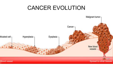 Cancer Risk and Ageing: What Older Adults Need